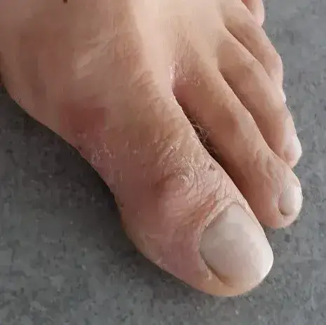 pied1